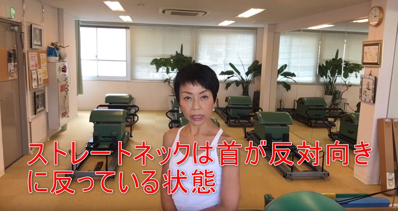 53-02_ストレートネックは首が反対向きに反っている状態